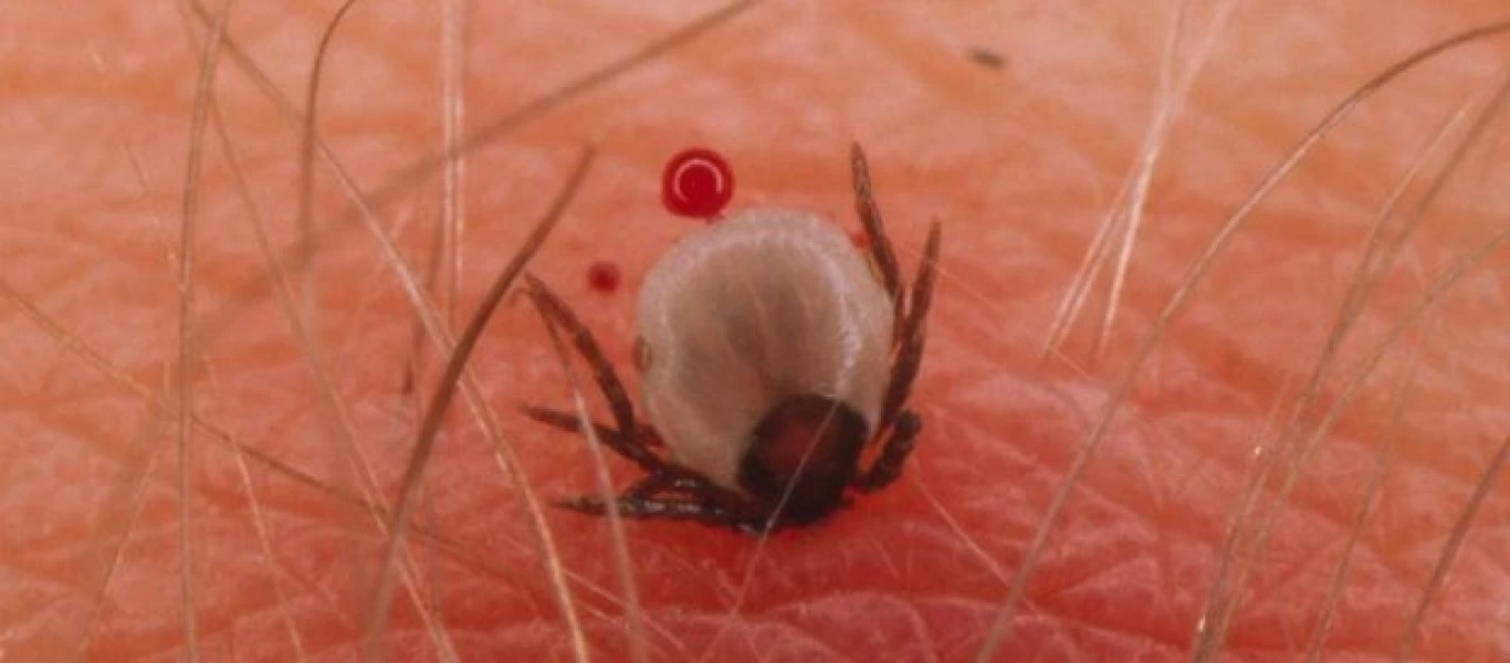 Τι είναι η Νόσος του Lyme από την οποία προσβλήθηκε ο Τζάστιν Μπίμπερ